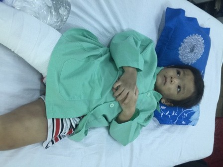 'Vợ chồng' gá nghĩa đánh bé trai 4 tuổi gãy xương đùi Cháu bé ngây thơ cho biết, không chỉ cháu mà đứa em nhỏ cũng bị cha mẹ đánh thường xuyên.