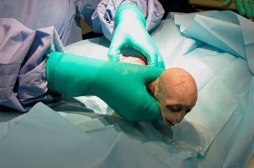 Khỉ sơ sinh có gương mặt giống Chúa tể Hắc ám Chú khỉ con có khuôn mặt giống Voldemort. Ảnh: SWINS.