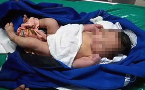 Bé gái hai tuần tuổi bị bỏ rơi trong thùng rác Bé gái được tìm thấy trong một thùng rác tại khu nghỉ dưỡng Patong trên đảo Phuket. Ảnh: CEN.