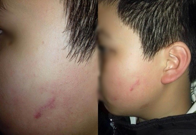 Chủ tịch Hà Nội: Làm rõ vụ giáo viên cho cả lớp tát vào mặt học sinh Chủ tịch Hà Nội: Làm rõ vụ giáo viên cho cả lớp tát vào mặt học sinh