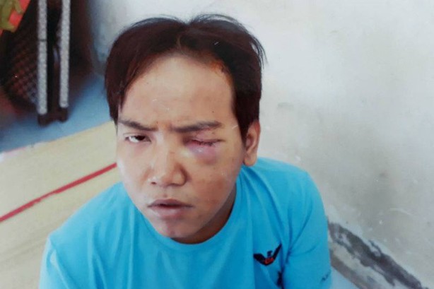 Chủ tịch phường không biết bảo vệ dân phố giết bé 6 tuổi bị tâm thần Hoàng Nhật Giang tại cơ quan công an. Ảnh: CA cung cấp.
