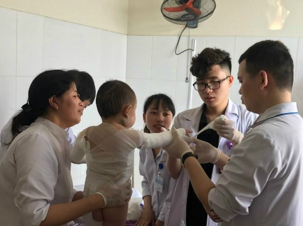 Bé gái 4 tuổi bị bỏng nước sôi toàn thân Bác sĩ thay băng cho bệnh nhi. Ảnh: Bệnh viện cung cấp.
