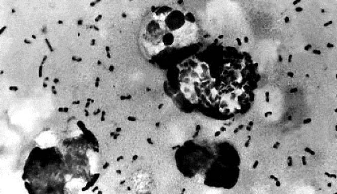 Dịch hạch bùng phát ở Madagascar, 40 người thiệt mạng Vi khuẩn dịch hạch Yersinia pestis dưới kính hiển vi - Ảnh: AFP