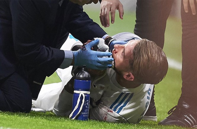 Thủ quân Real bị đá vỡ mũi ở derby Madrid Cú đá của Lucas khiến Ramos bị vỡ mũi. Máu chảy ròng ròng từ cả hai lỗ mũi của thủ quân Real và buộc bác sĩ vào sân cấp cứu.