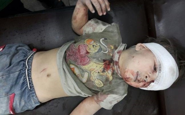 Bản tin 20H: Nga bác tin ném bom vào dân thường tại Aleppo Báo chí Phương Tây đăng tải hình ảnh cậu bé Omran, 5 tuổi, được cứu khỏi tòa nhà đổ nát ở khu vực bị phong tỏa tại Aleppo. (Nguồn: Telegraph)