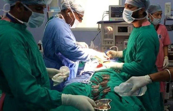 Kinh hãi phát hiện 40 con dao trong dạ dày người đàn ông Ca phẫu thuật lấy 40 con dao khỏi dạ dày nam bệnh nhân ở Ấn Độ.