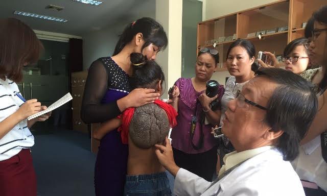 Người mắc bệnh “mai rùa” cực kỳ hiếm xuất hiện tại Việt Nam “Cô bé mai rùa” Việt Nam. Ảnh: Quốc Ngọc