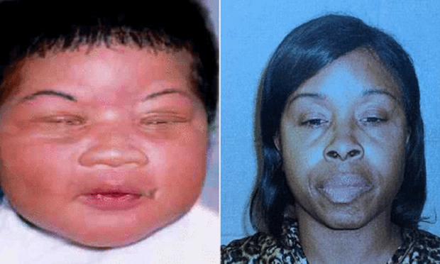 Phát hiện vụ bắt cóc trẻ sơ sinh cách đây 18 năm qua ADN Bé Kamiyah Mobley lúc bị bắt cóc (trái) và nghi phạm Gloria Williams.