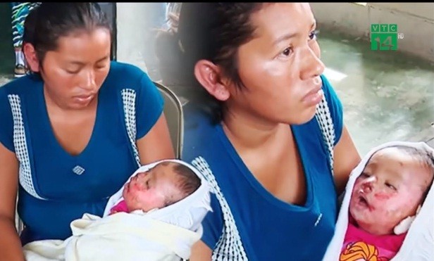 Bản tin 8H: Bé 7 tháng tuổi sống lại trong đám tang của chính mình Em bé 7 tháng tuổi được phát hiện còn sống trong đám tang.