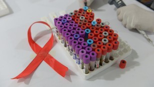 Trường hợp thứ 2 trên thế giới được chữa khỏi HIV Trường hợp thứ 2 trên thế giới được chữa khỏi HIV