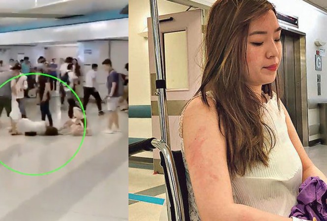 'Ma trận' tin giả ở Hong Kong Bức ảnh người phụ nữ mang bầu nằm trên sàn nhà ga ở Hong Kong. (Ảnh: SCMP)