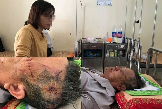Cụ ông kể lại giây phút vật lộn với kẻ sát hại cựu giáo viên Ông Đ. đang được điều trị tại bệnh viện.