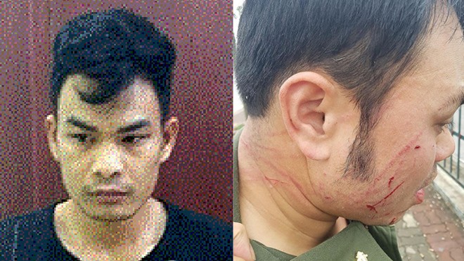 Bắt đối tượng bị truy nã đánh gãy 4 răng nhân viên sân bay Nội Bài Hoàng Văn Trường và nhân viên sân bay bị hành hung gãy 4 răng cửa.