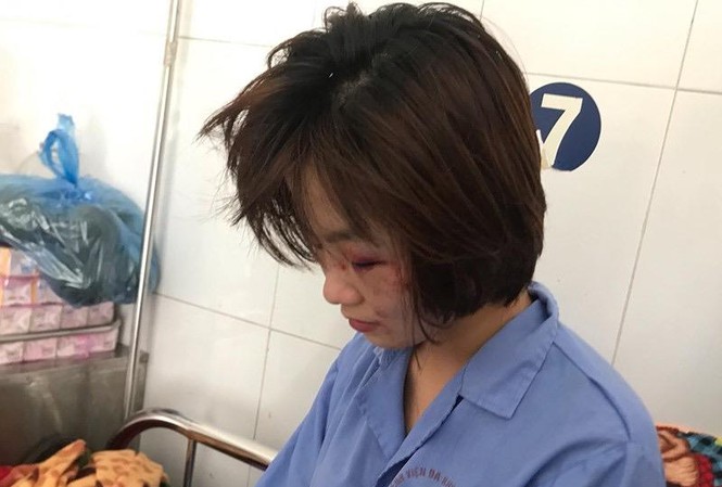 Nữ phụ xe buýt kể lại phút bị nhóm thanh niên đánh hội đồng dã man Chị H. đang được điều trị tại bệnh viện.