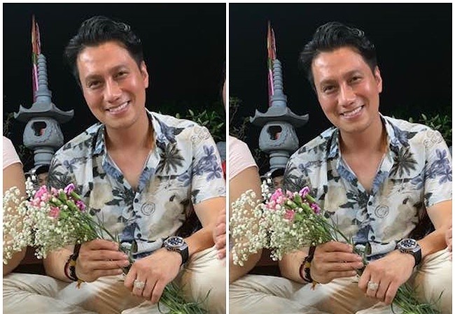Showbiz 16/8: Giữa ồn ào phẫu thuật thẩm mỹ ‘lỗi’, Việt Anh tiết lộ bất ngờ Hình ảnh mới nhất của Việt Anh sau gần 2 tháng phẫu thuật thẩm mỹ.