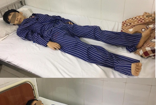 Lạng Sơn: Hai trẻ nhỏ nguy kịch nghi ăn xôi phẩm màu Hai anh em bị ngộ độc đang cấp cứu tại bệnh viện .Ảnh: Đ.K