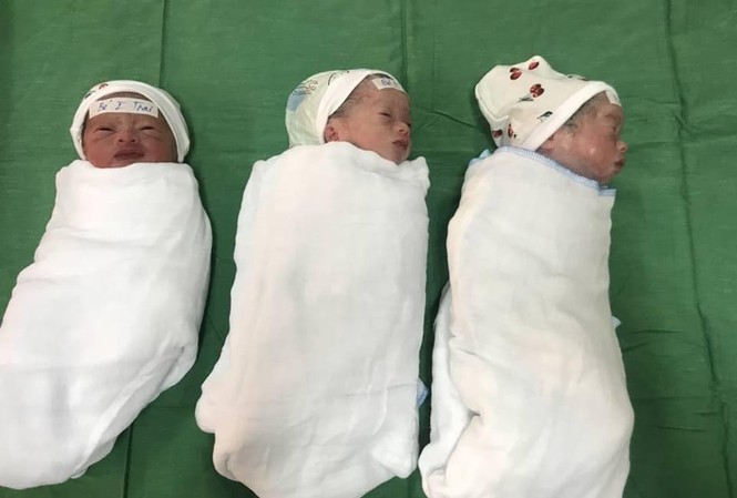 Nghệ An: Sản phụ 23 tuổi sinh 3 hiếm gặp Nghệ An: Sản phụ 23 tuổi sinh 3 hiếm gặp