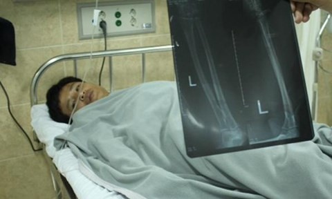 Chặn đầu xe tải để cướp, chém tài xế đứt gân tay Chặn đầu xe tải để cướp, chém tài xế đứt gân tay