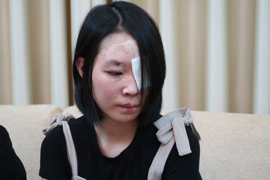 Tâm sự đau đớn của nữ sinh bị tạt axit giữa đường Khuôn mặt của nạn nhân bị biến dạng, hư mắt trái