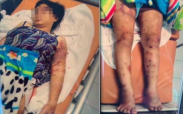 Ghê rợn vụ tra tấn thai phụ: Bắt nạn nhân hít ma tuý, dùng ná bắn vào vùng kín Chị Y bị hành hạ dã man và ép sử dụng ma túy đến sẩy thai