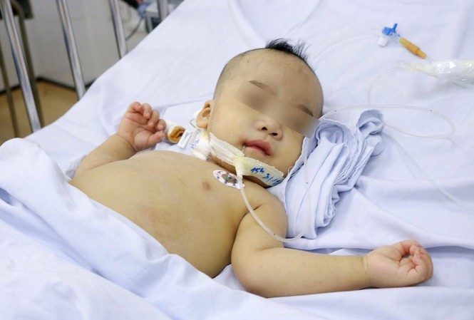 Sốc nhiễm trùng, bé trai 99% tử vong được cứu sống kỳ diệu Sốc nhiễm trùng, bé trai 99% tử vong được cứu sống kỳ diệu
