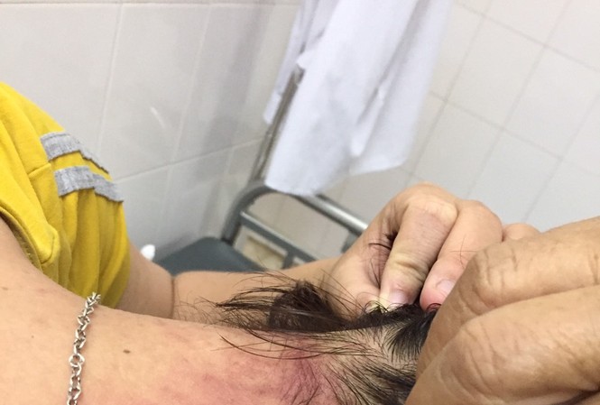 Nhiều bệnh nhân thành nạn nhân của kiến ba khoang... khi nằm viện Nhiều bệnh nhân thành nạn nhân của kiến ba khoang... khi nằm viện