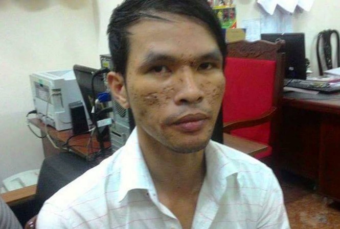 Bắt giữ nghi can hành hạ trẻ em gây phẫn nộ trên mạng Nghi can Dũng tại cơ quan điều tra.