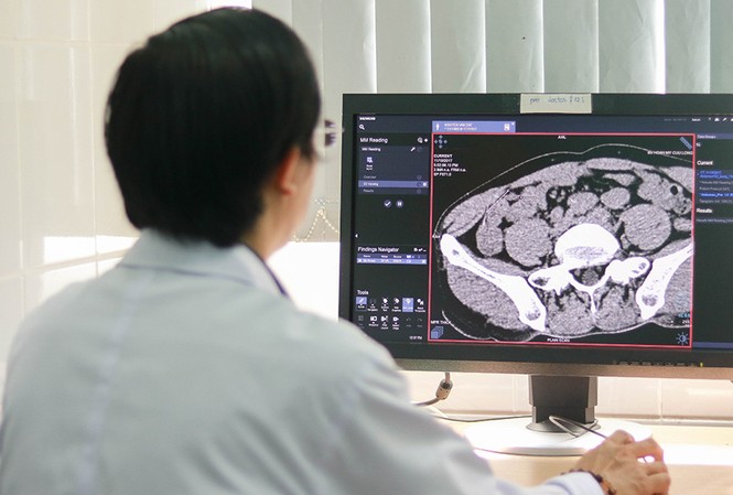 Phẫu thuật thành công bệnh nhân bị hóc xương cá đâm thủng ruột thừa Phim chụp xương cá mắc trong ruột thừa gây viêm (Ảnh bệnh viện cung cấp).