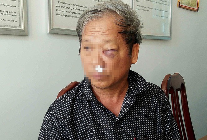 Phóng viên VTV bị 2 côn đồ hành hung dã man Nhà báo Hoàng Đình Chiểu tại Bệnh viện đa khoa tỉnh Kon Tum