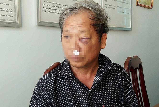 Tỉnh Kon Tum vào cuộc vụ phóng viên VTV bị đánh dã man Nhà báo Hoàng Đình Chiểu