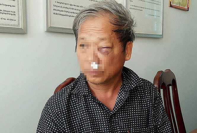 Luật sư lên tiếng vụ phóng viên VTV bị đánh dã man Nhà báo Hoàng Đình Chiểu