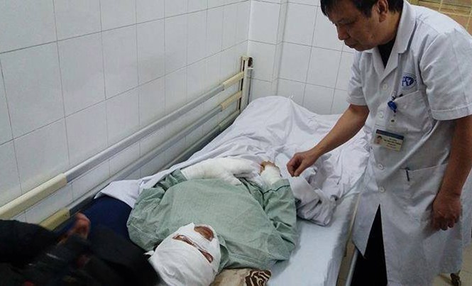 Cảnh báo bỏng nặng, mù mắt do nổ bóng bay Bác sĩ thăm khám bệnh nhân bỏng do nổ bóng chứa hydro.