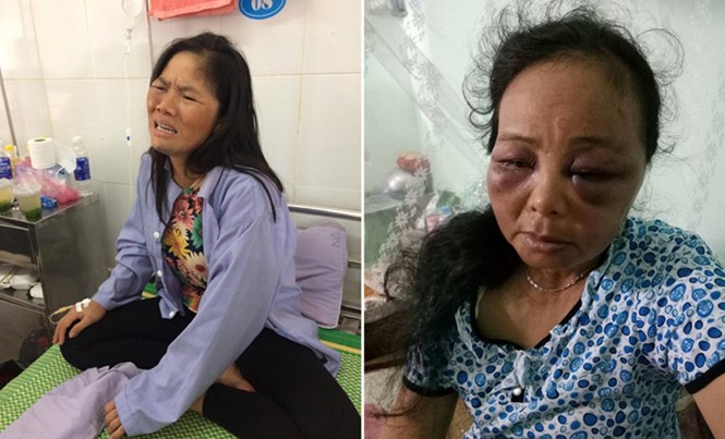Gia cảnh ngậm ngùi của người bị đánh oan Hai người phụ nữ bị đánh do người dân hiểu nhầm.