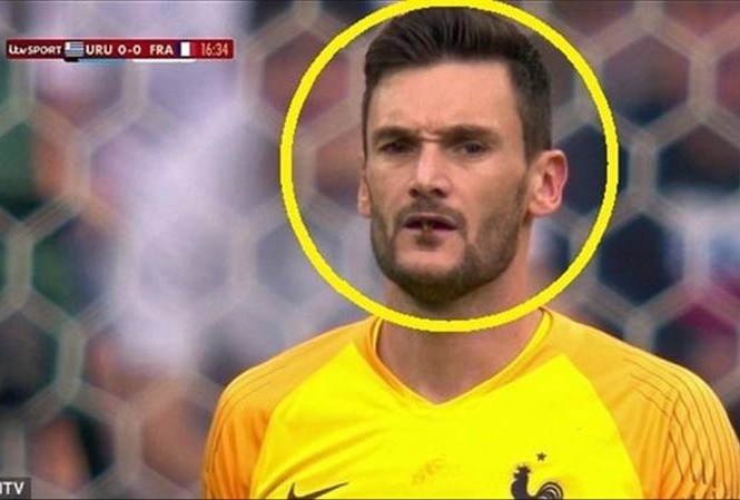 Thủ môn tuyển Pháp suýt nuốt phải côn trùng khi đấu Uruguay Thủ môn tuyển Pháp suýt nuốt phải côn trùng khi đấu Uruguay