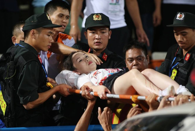 Nữ khán giả bị thương vì trúng pháo sáng trận Hà Nội - Nam Định Lực lượng an ninh và bác sĩ chuyển nữ CĐV bị thương vì pháo sáng đi bệnh viện. Ảnh: Vnexpress