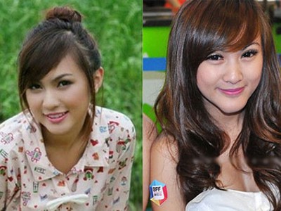 Những ca mổ kinh hoàng của Hot girl suýt mất... cằm vì làm đẹp Những ca mổ kinh hoàng của Hot girl suýt mất... cằm vì làm đẹp