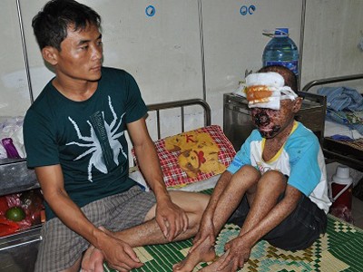 Cậu bé 9 năm mang khuôn mặt ‘quỷ’ Cậu bé 9 năm mang khuôn mặt ‘quỷ’