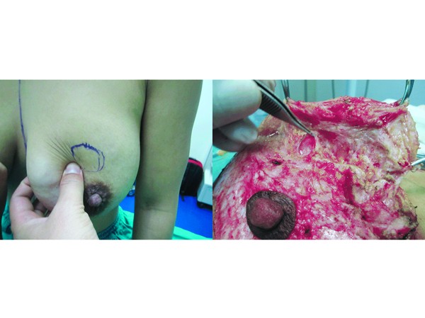 Hậu quả thảm khốc Hậu quả thảm khốc