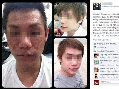 'Hot boy' hóa 'dị nhân' bởi tẩy trắng da 'Hot boy' hóa 'dị nhân' bởi tẩy trắng da