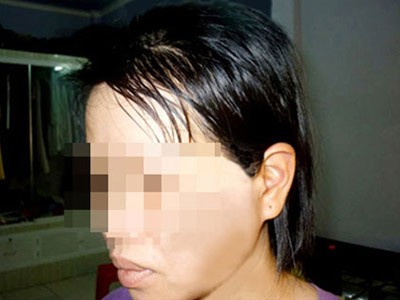Xung quanh vụ bác sĩ bạo hành vợ ép ly hôn Xung quanh vụ bác sĩ bạo hành vợ ép ly hôn