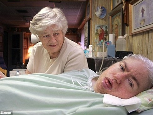 Cô gái ‘ngủ quên’ suốt 42 năm Cô gái ‘ngủ quên’ suốt 42 năm