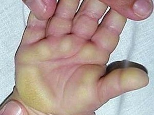 Chưa tìm ra độc chất gây 'bệnh lạ' tại Quảng Ngãi Chưa tìm ra độc chất gây 'bệnh lạ' tại Quảng Ngãi