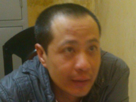 Chân dung kẻ phê ma túy, vào bệnh viện cắt chân chị gái Chân dung kẻ phê ma túy, vào bệnh viện cắt chân chị gái