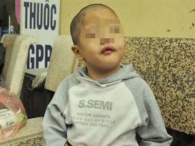 Bé năm tuổi bị bỏ rơi không bị xâm hại tình dục Cháu Hạnh hiện vẫn đang được cưu mang tại chùa Bồ Đề