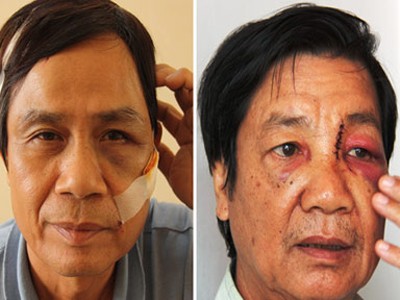 Một người Bỉ đánh gục hai bảo vệ chung cư Một người Bỉ đánh gục hai bảo vệ chung cư