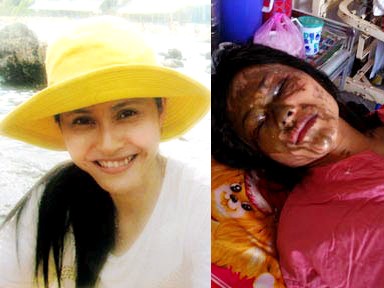 Nỗi kinh hoàng mang tên 'axit' Nỗi kinh hoàng mang tên 'axit'