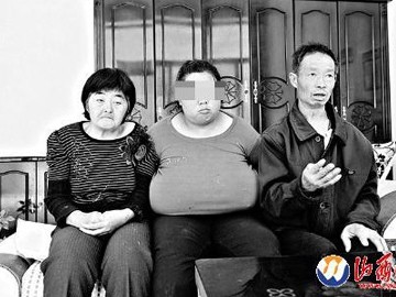 Cô gái có bộ ngực khổng lồ nặng đến 5kg Cô gái có bộ ngực khổng lồ nặng đến 5kg