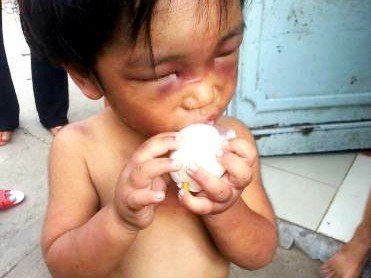 Cháu bé ba tuổi bị cậu đánh đập dã man, bắt đi ăn xin Cháu Đức ăn ngấu nghiến sau những ngày đói lả