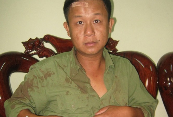Kiểm lâm nhập viện vì... bị nhiều phụ nữ cắn Kiểm lâm nhập viện vì... bị nhiều phụ nữ cắn