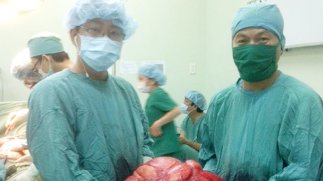 Cụ ông mang khối u 11kg trong bụng Khối u 11 kg lấy khỏi ổ bụng bệnh nhân sáng 21/5. Ảnh: Đ.X.